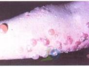 大皰性類天皰瘡