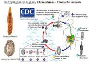 華支睪吸蟲病