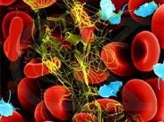 高滲性非酮癥糖尿病昏迷