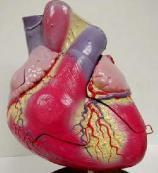 急性右側心力衰竭