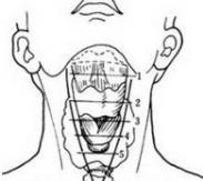 咽部及頸部食管閉合性損傷