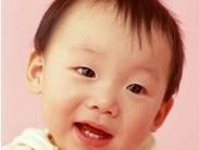 小兒雙唇綜合征