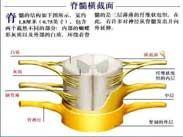 亞急性壞死性脊髓炎