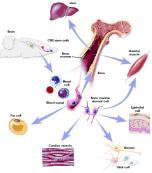 進(jìn)行性肥厚性間質(zhì)性神經(jīng)炎