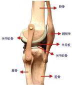 月狀骨骨軟骨病