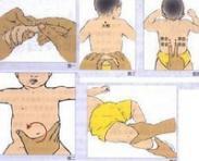 血栓閉塞性脈管炎