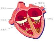 心室內傳導阻滯